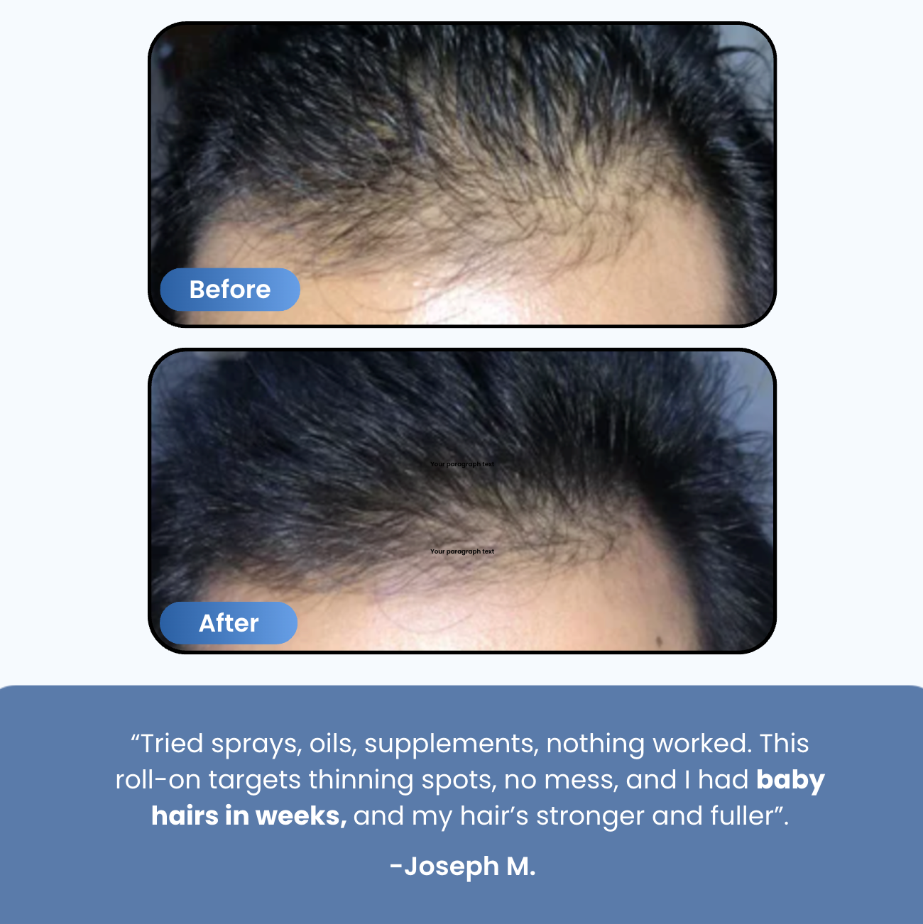 Precision Hair Recovery Roll-On®