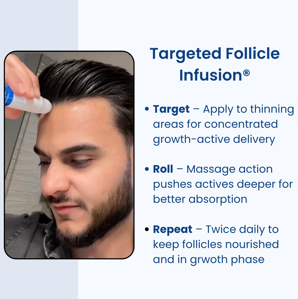 Precision Hair Recovery Roll-On®